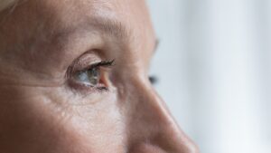 60 year old woman has drooping eyelids but can benefit from eyelid surgery (aka blepharoplasty)