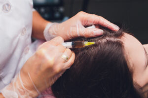 Mature couple has healthy heads of hair after PRP treatments.
